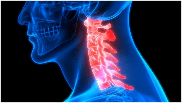 ból szyi prowadzi do bólu pleców