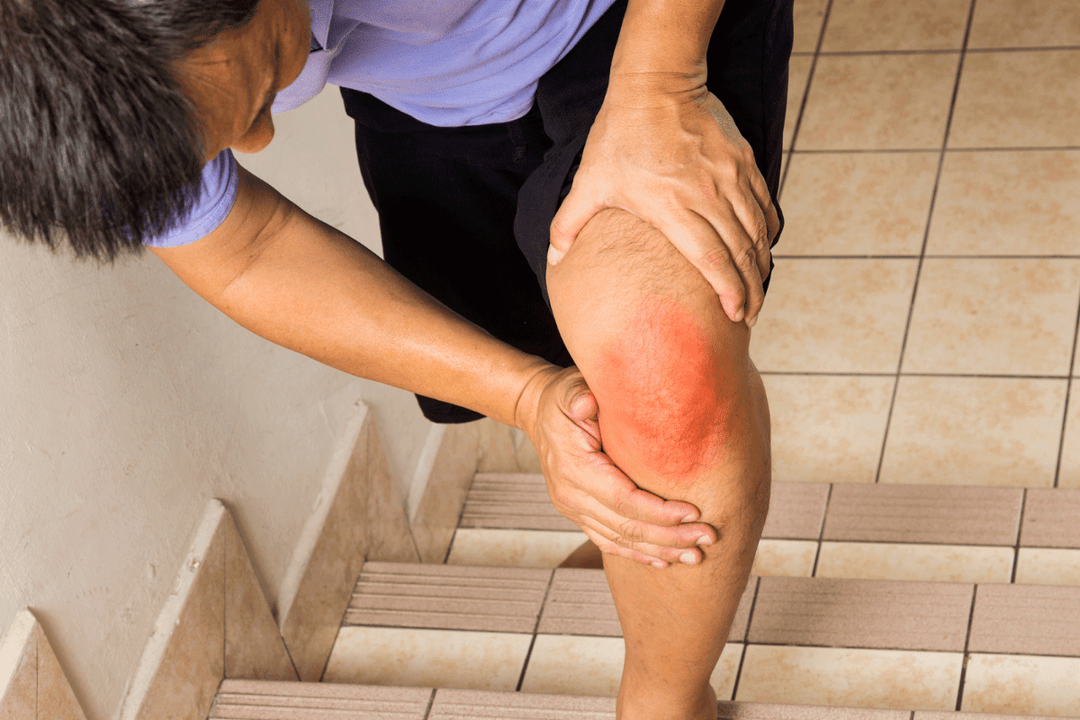 ból stawów spowodowany artrozą